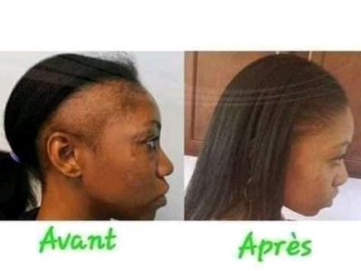 HUILE DE CHEBE POUR LA POUSSE RAPIDE DES CHEVEUX